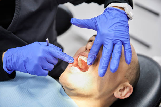Best Emergency Gum Treatment in North Randall, OH